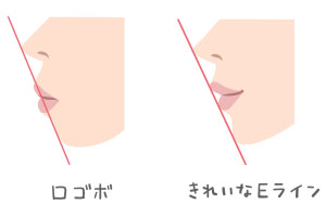 矯正治療で顔の印象は変わる？起こりうる顔の変化とは