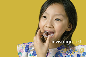 子どものインビザライン「インビザライン・ファースト」は何歳からできる？