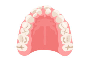 普通よりも歯の本数が多い「過剰歯」。歯並びに影響はある？